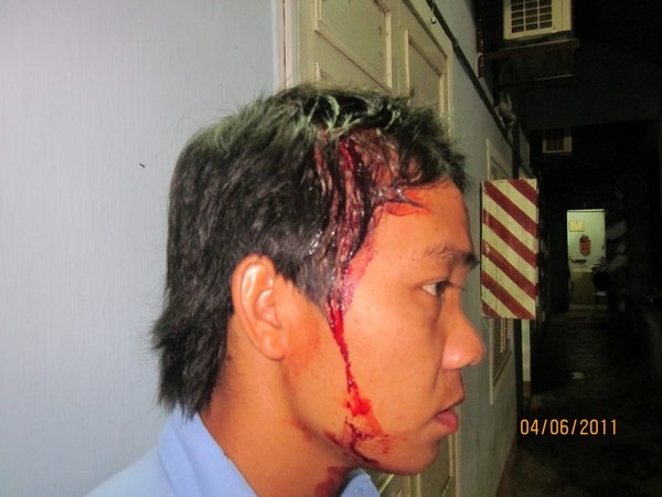 Hơn 300 đối tượng tấn công mỏ vàng, cướp 10 tấn quặng vàng - 1