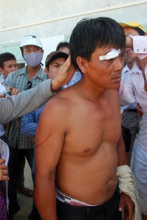 Côn đồ chém người, hàng trăm dân lại bao vây trụ sở đơn vị thi công - 3 Côn đồ chém người, hàng trăm dân lại bao vây trụ sở đơn vị thi công - 3