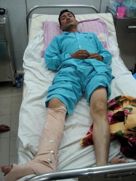 Chủ quán bị chém vì “tội” đông khách - 1