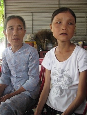 Một cô gái trẻ bị “lão hóa” vì không tìm ra căn bệnh nan y