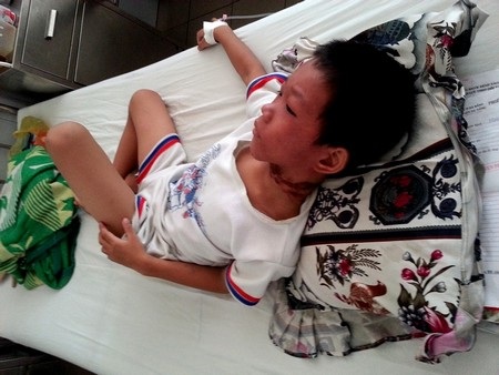 Ly kỳ cậu bé 8 tuổi tự giải thoát khi bị trói, ném xuống hố sâu - 1 Cháu Mắm còn mệt và đang truyền nước trên giường bệnh