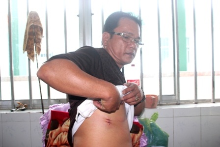 3 công an bị đâm khi khống chế kẻ dọa giết người - 1 Ông Hồ Tăng, Phó trưởng Công an xã Tam Xuân 1 bị đâm vào vùng ngực phải. Ảnh: C.A.