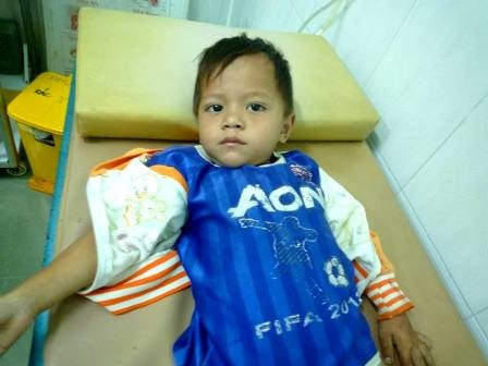 Gắp một con sên từ mũi cháu bé 3 tuổi - 1 Cháu Hữu sau khi được gắp con sên trong mũi