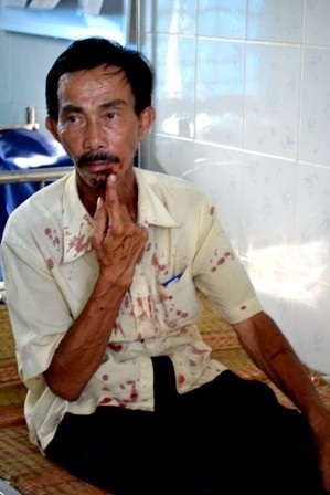 Ông Nguyễn Tấn Oai bị đánh trọng thương. Ảnh: T.L.