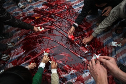 Nếu bị đau tim - Đừng xem chém lợn - 24