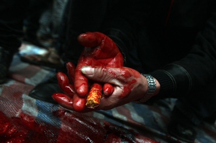 Nếu bị đau tim - Đừng xem chém lợn - 26