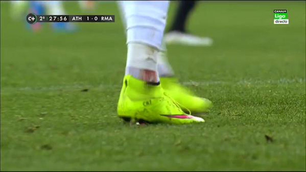 Mắt cá chân của C.Ronaldo thấm đẫm máu sau pha va chạm với cầu
thủ Bilbao