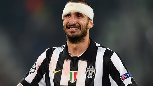 Barcelona, Juventus chốt danh sách dự chung kết Champions League - 1 Juventus mất Chiellini ở trận chung kết Champions League