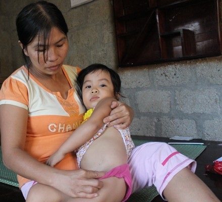 Từ khi sinh ra, bé Nhi đã mang trên mình đủ thứ bệnh tật