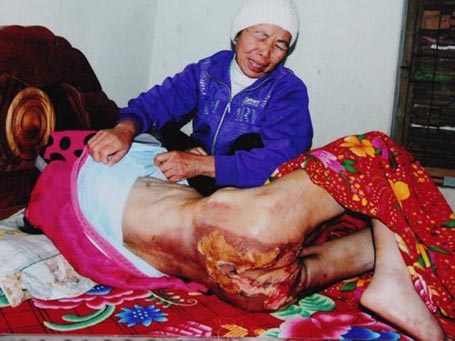 Đề nghị truy tố bà chủ bắt người giúp việc ăn phân