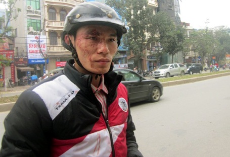 Đuổi việc phụ xe buýt hành hung khách