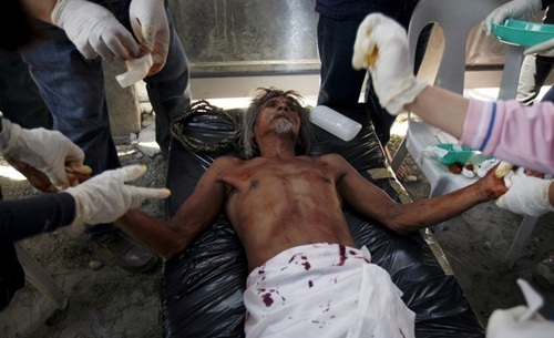 “Rùng mình” với lễ hội đóng đinh người thật ở Philippines - 8 Những người bị thương được đưa tới trạm y tế điều trị