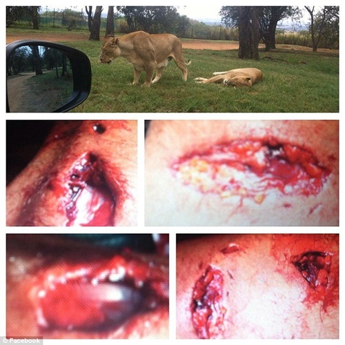 Hình ảnh vết thương do sư tử cắn được anh chia sẻ