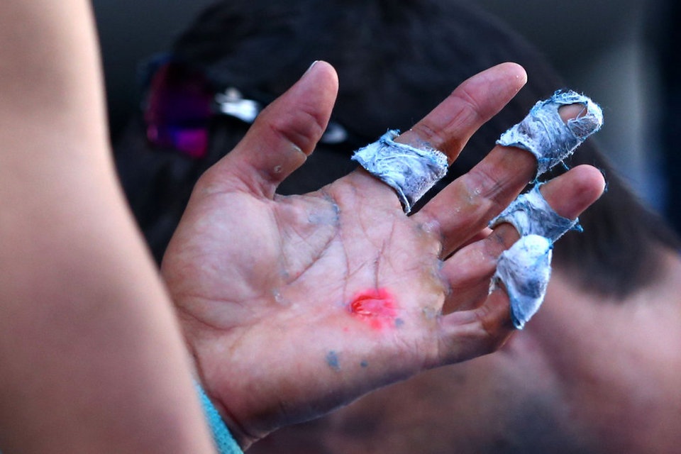 Nhìn lại những khoảnh khắc ấn tượng của thể thao thế giới 2014 - 7 Bàn tay của
Rafa Nadal trong trận đấu với Grigor Dimitrov tại Australia mở rộng.