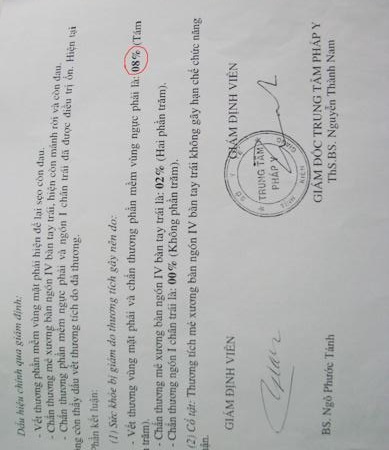 Kết quả giám định thương tật sau khi xảy ra vụ đánh là 15%...