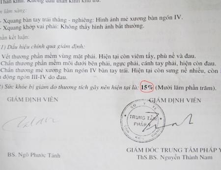 Kết quả giám định thương tật sau khi xảy ra vụ đánh là 15%...