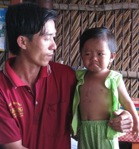 Dù đã được phẫu thuật nhưng bệnh tình của cháu Khả Hân vẫn chưa khỏi hẳn.
