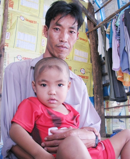 Đắng lòng trước khuôn mặt lanh lợi của cậu bé "ngồi cũng bị ngã" - 4 Từ ngày bị tai nạn, cậu bé Đầy chỉ có thể nằm quặt quẹo trong sự chăm sóc của cha.