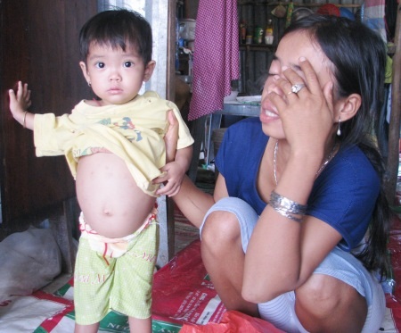 Ám ảnh ánh mắt “khát sống” của cô bé 2 tuổi bị to lá lách - 4 Người mẹ nghèo bất lực trước ánh mắt khát sống của cô con gái bé bỏng này.