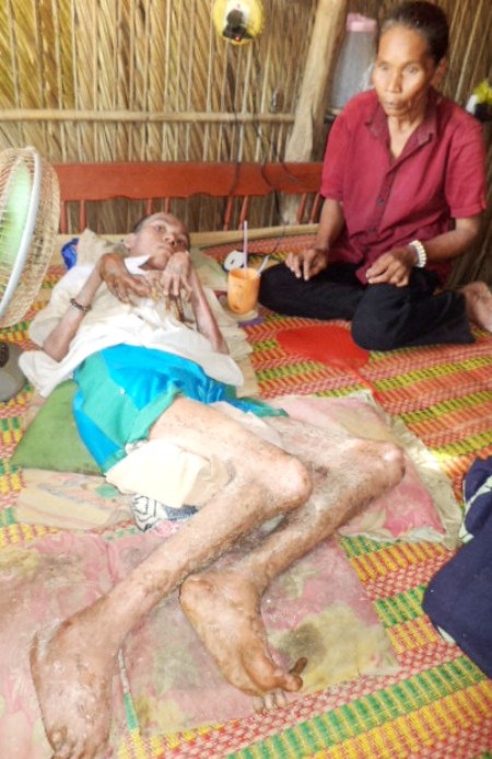 Người mẹ nghèo với nỗi đau nhiều năm nhìn con trai khác người thường.