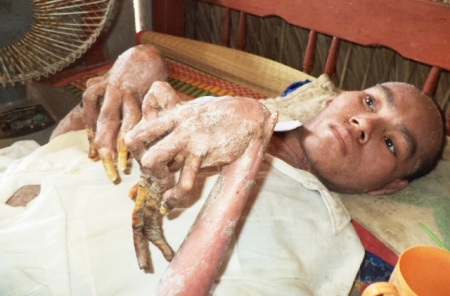 Không chỉ anh Sang không biết bệnh gì...