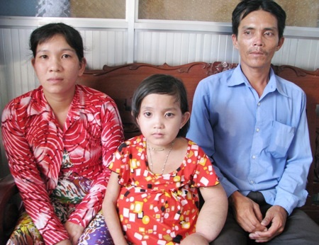 Thương bé lớp 5 với cơ thể dị dạng "tay to, bụng bự" - 5 Bụng của cháu Diễm lại bị túi nước nên trông rất dị thường.