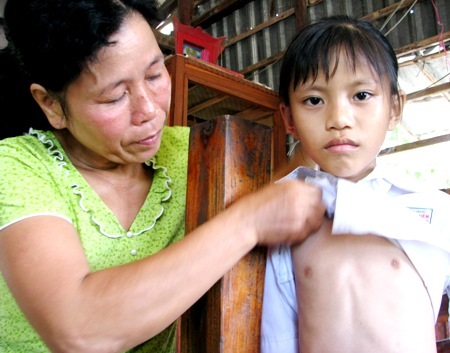 Thương bé lớp 3 mỗi ngày không có thuốc là chết - 1 Thương bé lớp 3 mỗi ngày không có thuốc là chết