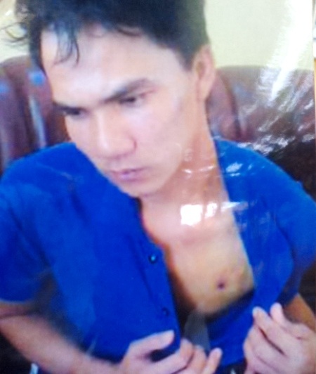 Học viên Lê Trọng Nhân với nhiều vết thương ở ngực nghi do súng cao su bắn.