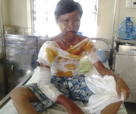 Em Nguyễn Trung Tình đang điều trị tại BVĐK Bạc Liêu. (Ảnh: Huỳnh Hải)
