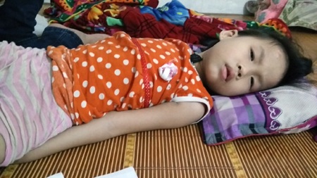 Cháu Bảo Trâm đang có nguy cơ liệt giường vì căn bệnh teo cơ hóa tủy bẩm sinh hiếm gặp