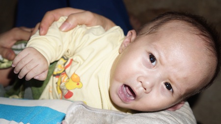 Xót xa cháu bé 6 tháng tuổi không có hậu môn kèm bệnh tim bẩm sinh - 4 Bé khóc trong đau đớn.