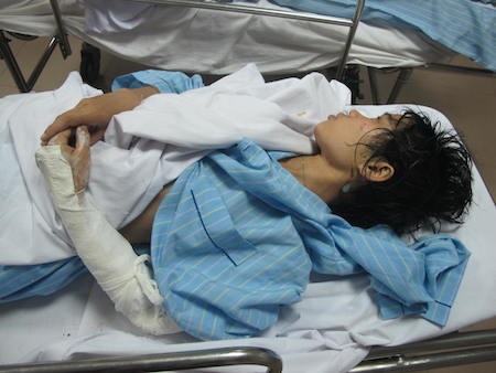 Các nạn nhân đang được chăm sóc tại BV 115 Nghệ An.