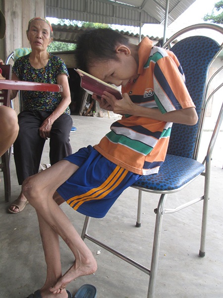 Cậu bé tật nguyền dùng việc học quên đi nỗi đau - 7 Trên lớp học, mỗi khi viết vào vở là Lộc phải dí sát mặt.