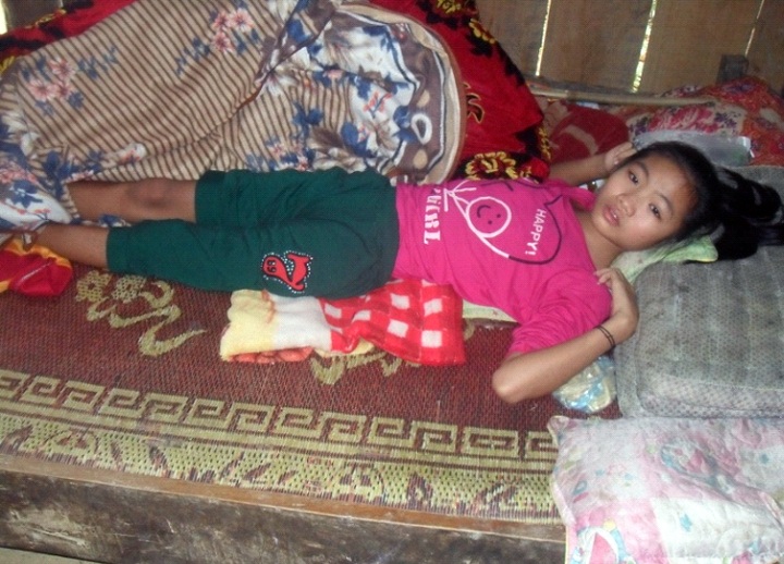 Thiếu 50 triệu đồng, nữ sinh lớp 8 chết mòn vì gãy xương đùi phức tạp