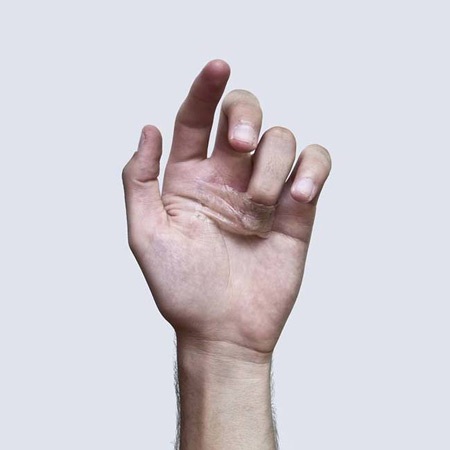 “Chiếc túi sau đó được thêm đất...