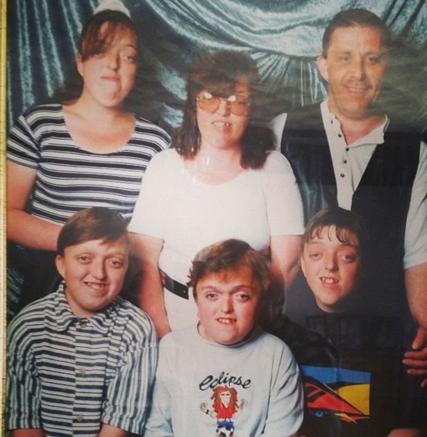 Trường hợp hiếm gặp: Steve và gia đình.