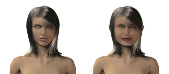 Bị bạnh cằm vì nhai kẹo cao su để giảm cân