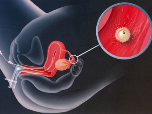 Sản xuất tinh trùng trong ống nghiệm