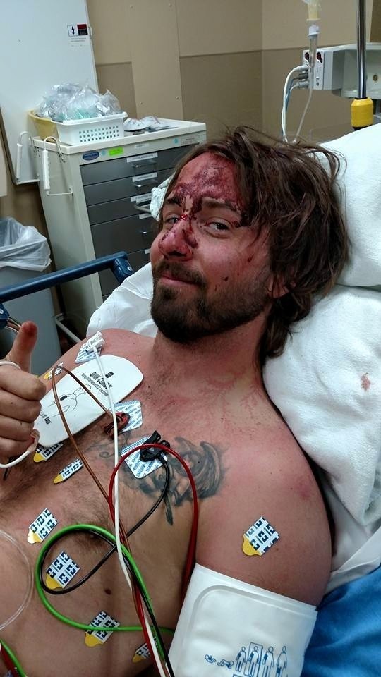 Chó cứu chủ khỏi chết vì sét đánh - 2 Không có Rambo hứng phần lớn sét, Hardman cũng đã chết.