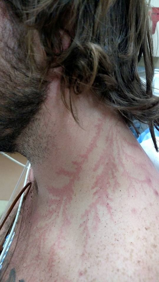 Chó cứu chủ khỏi chết vì sét đánh - 3 Tấm ảnh cuối cùng Hardman chụp cùng bạn thân nhất của mình - chú chó Rambo: