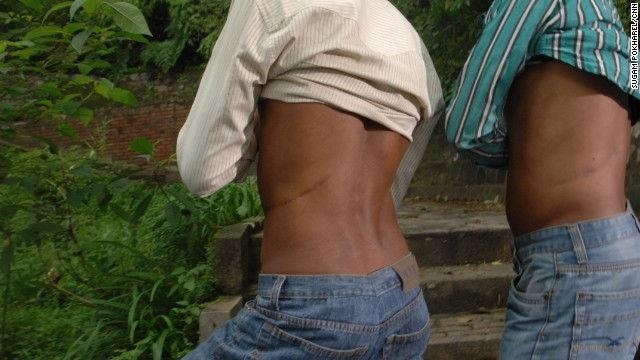 Làng thận ở Nepal