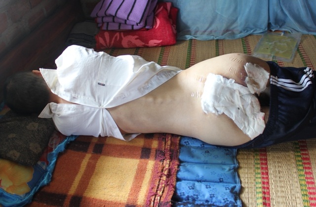 Mọi sinh hoạt hàng ngày của anh Thắng đều do vợ hay mẹ lo