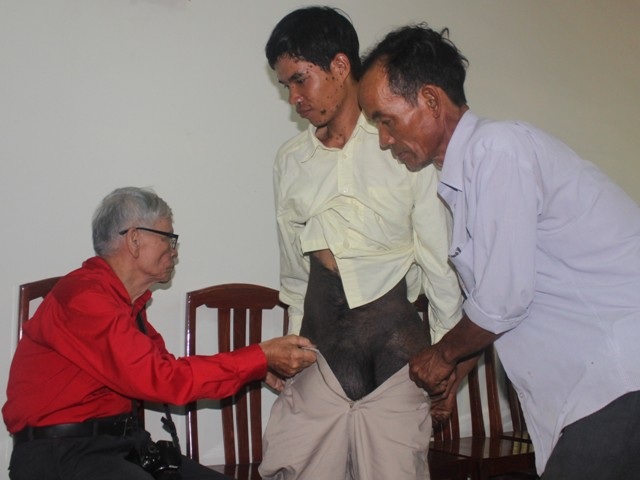 Chàng trai Đào Văn Đông mong một ngày được trở lại người bình thường