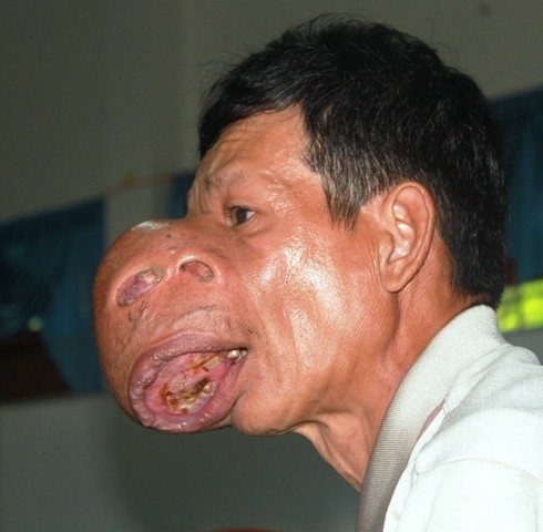 Có những người gần cả đời mang khuôn mặt giống quỷ