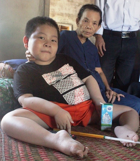 Thêm 18 triệu đến với 3 anh em xương mềm như bún