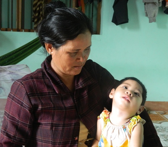 18 tháng qua cuộc sống của cháu Bảo Bảo chỉ là những cơn cơ giật do bị động kinh