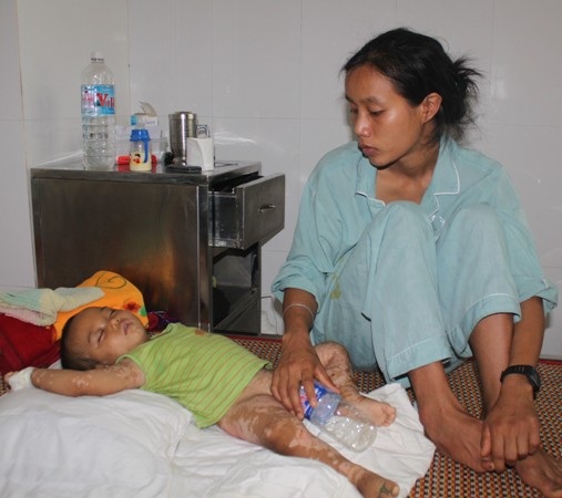 Hơn 1 tuần sau điều trị da bé đã khô nhưng có thể bé phải uống thuốc suốt đời