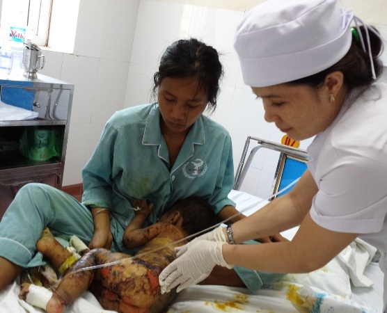 Thương bé 1 tuổi bị lở loét toàn thân - 2 A Phung khi mới nhập viện