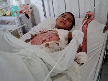 Anh Nguyễn Văn Lực đang dần bình phục - 2