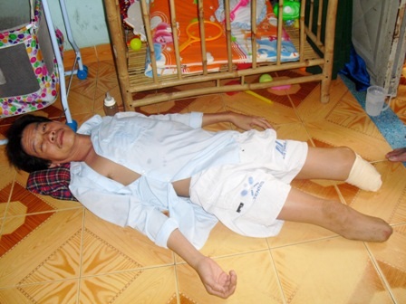 Căn bệnh tiểu đường đã cướp đi đôi chân và đang tấn công đôi mắt anh Vinh